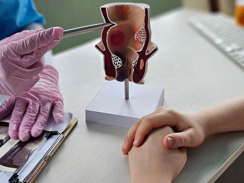 A patient consulting a doctor regarding colorectal health