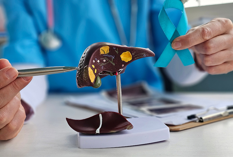 A doctor holding a liver cancer awareness ribbon